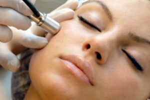 microdermabrasion