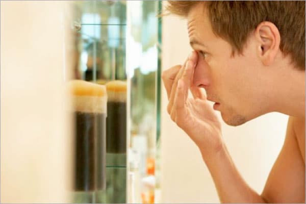 skin-problems skin problems