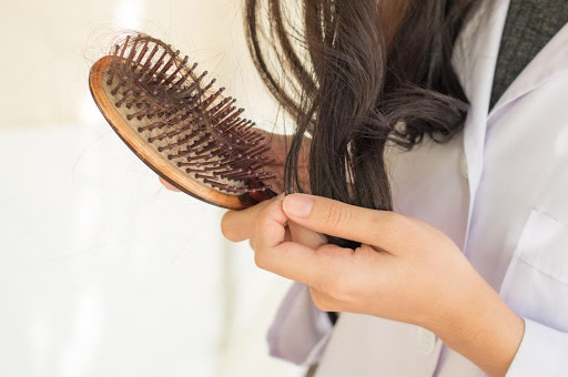 hair-loss2